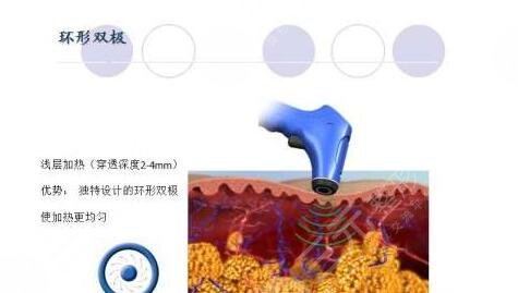 深藍(lán)射頻適合多大年齡?