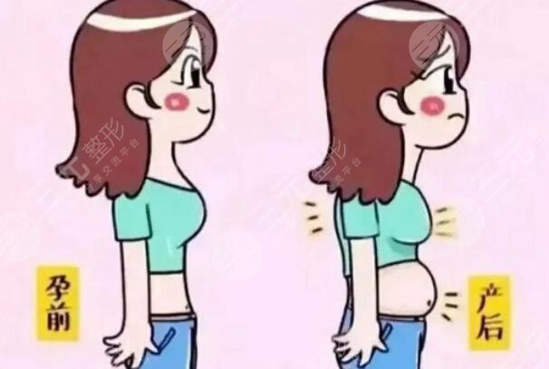 產(chǎn)后瘦身需要注意什么問題?