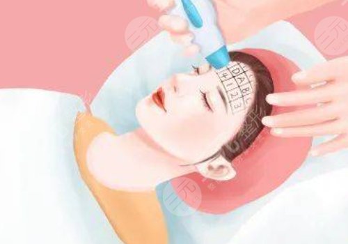 微調(diào)整形都有什么項(xiàng)目？