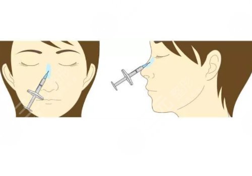 微創(chuàng)整形美容診療范圍有哪些？