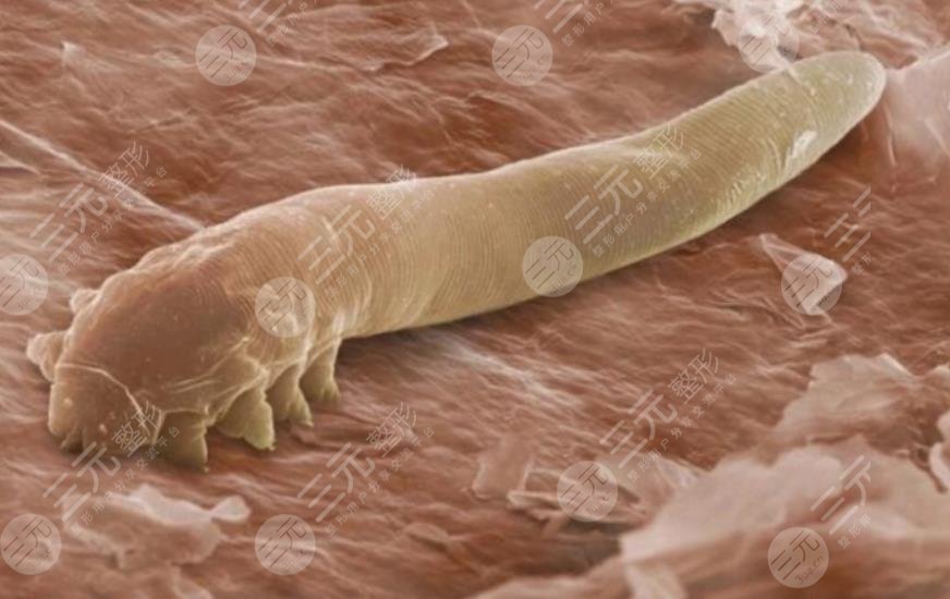 螨蟲感染皮膚的癥狀