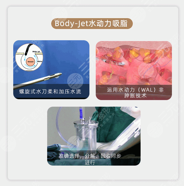 蝴蝶袖手臂吸脂多少錢？價(jià)格費(fèi)用更新！3家優(yōu)質(zhì)機(jī)構(gòu)分享~