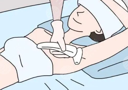 激光脫毛和冰點(diǎn)脫毛哪個(gè)好？