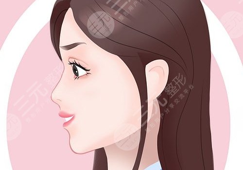 打玻尿酸隆鼻子有副作用嗎？