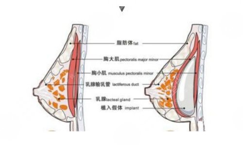 強(qiáng)生傲諾拉和曼托區(qū)別在哪？