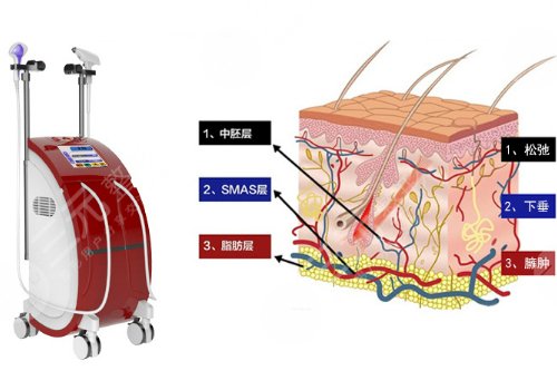 黃金熱拉提2.0做一次能維持多久？