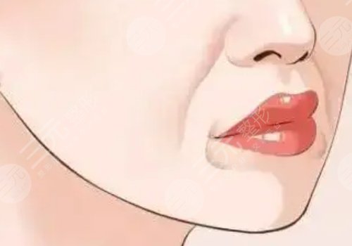 黃金熱拉提2.0做一次能維持多久？