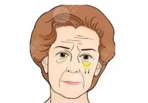 楊麗美顏?zhàn)鲂迯?fù)怎么樣?