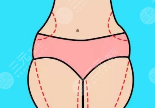 如何有效減肥不反彈？