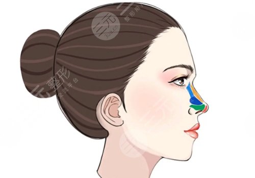 硅膠隆鼻好不好？