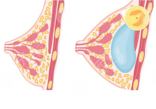 鄭州大學(xué)第二附屬醫(yī)院整形科怎么樣