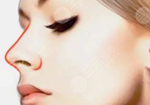 童列健和張武那個修復(fù)鼻子好