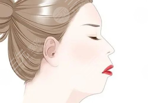 下顎線提升整形有什么做法？