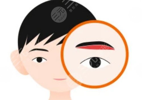 提眉的好處和壞處有什么？