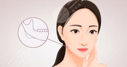 沈陽(yáng)杏林磨骨怎么樣