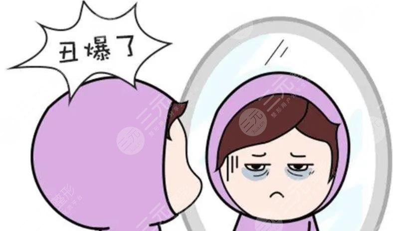 外切眼袋增生鼓包多久消退