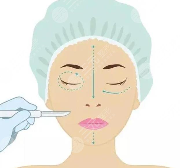 外切眼袋加眶隔釋放加填充淚溝