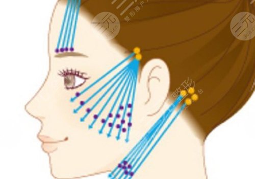 做完線雕多久可以恢復(fù)？