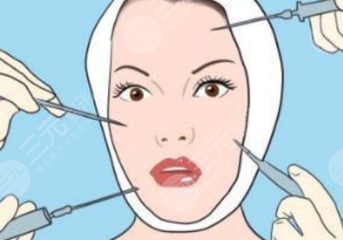 輪廓針可以打哪些地方？