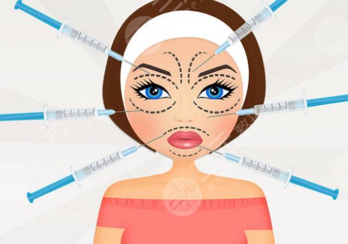 輪廓針可以打哪些地方？