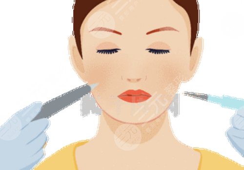 輪廓針可以打哪些地方？