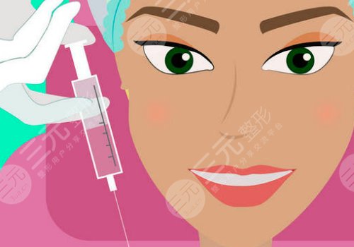 輪廓針可以打哪些地方？