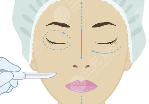 內(nèi)輪廓是指哪里部位？