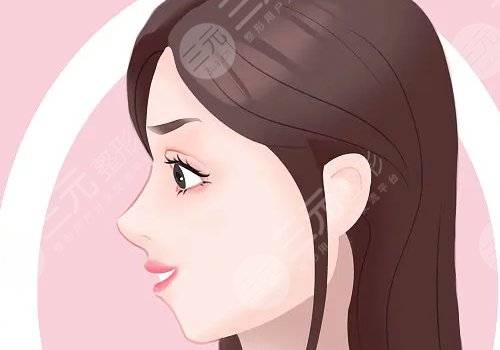 葉麗萍做鼻子怎么樣