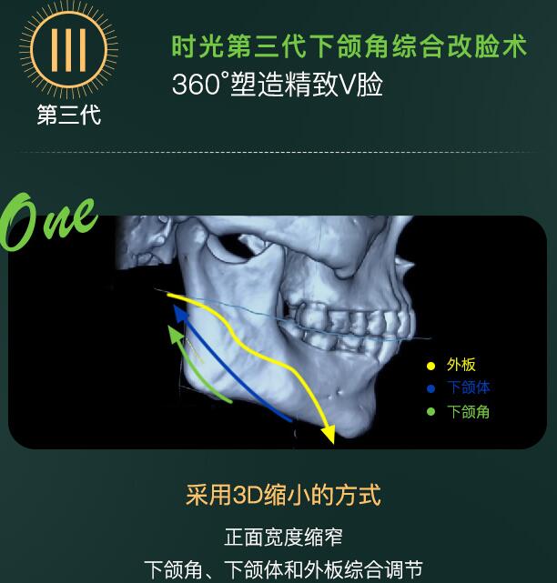 杭州時光醫(yī)療美容醫(yī)院是三甲嗎，技術怎么樣？測評報告&價格一覽！