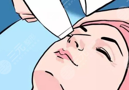 豐顏玻尿酸多久能消腫？