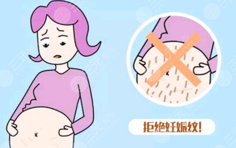 妊娠紋怎么消除