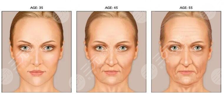 臉部拉皮手術(shù)怎么做?