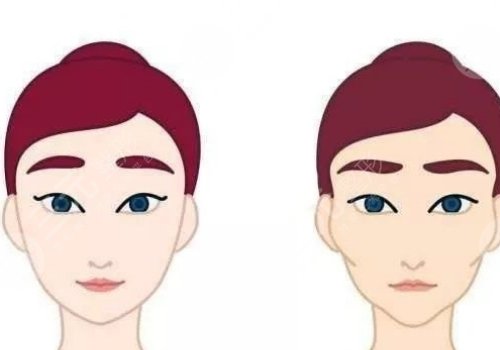 輪廓手術(shù)危險(xiǎn)嗎？