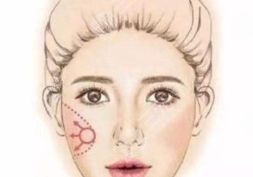 內輪廓線和外輪廓線的區(qū)別是什么