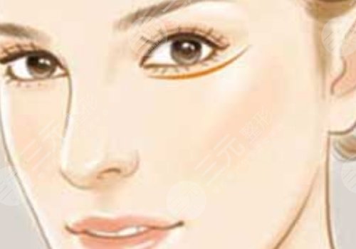 注射伊妍仕腫一個(gè)多月正常嗎？