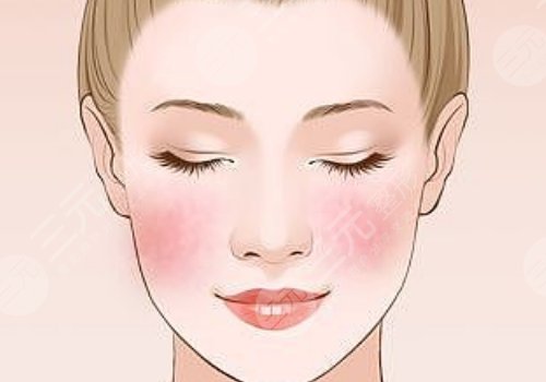 注射伊妍仕腫一個(gè)多月正常嗎？