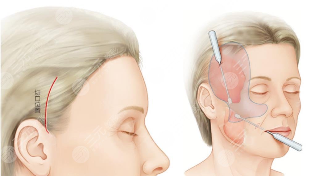 王馳醫(yī)生擅長項(xiàng)目科普