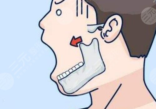 做輪廓手術(shù)多少錢費用是多少？