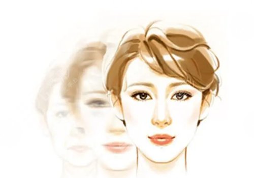 眉弓骨填充前后照片(案例)