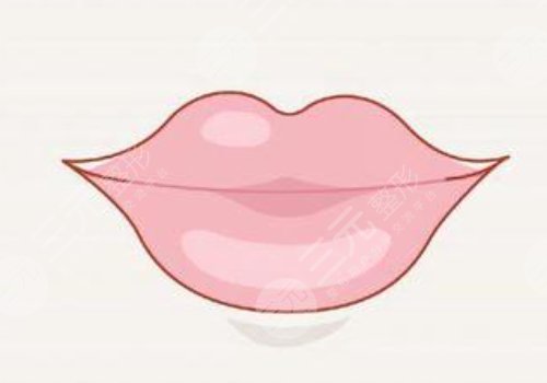 微笑唇打玻尿酸能保持多久？