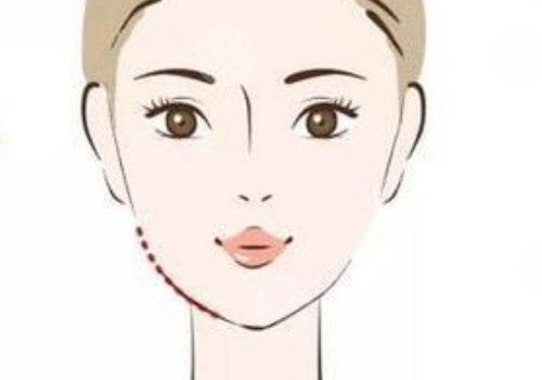 小v臉提升怎么做多少錢？