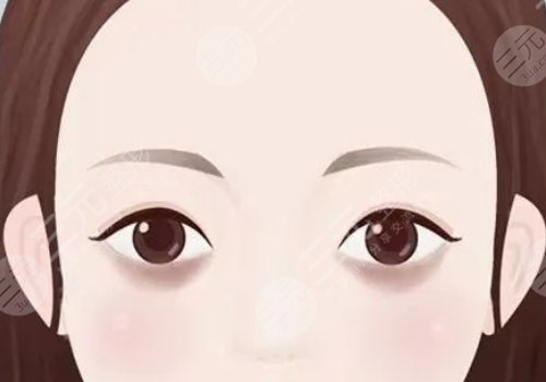 去黑眼圈和眼袋有效的方法是什么？眼周抗衰指南！