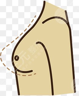 陳萬芳脂肪豐胸案例