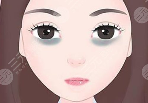去黑眼圈手術(shù)多少錢??？