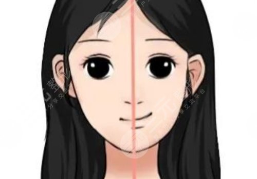 大小臉矯正手術(shù)有風險嗎？