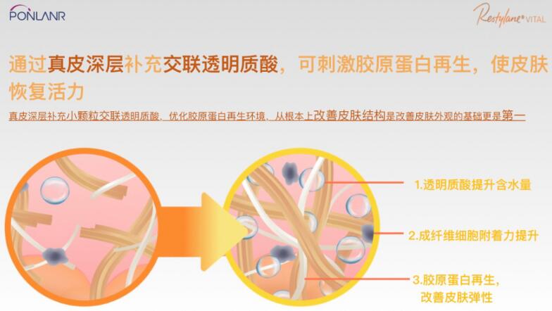 貴婦水光效果怎么樣？高奢維養(yǎng)，美膚指南！