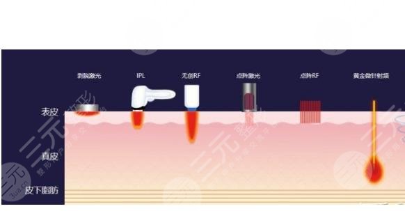 去黑眼圈和眼袋有效的方法是什么？眼周抗衰指南！