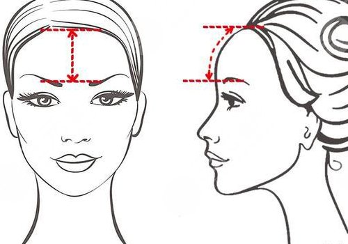 中庭太長怎么改良？