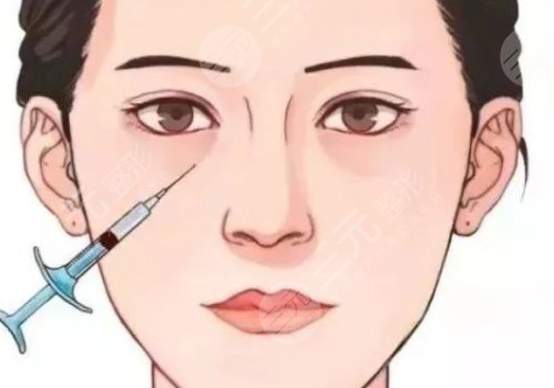 雙美膠原蛋白填充淚溝能維持多久？