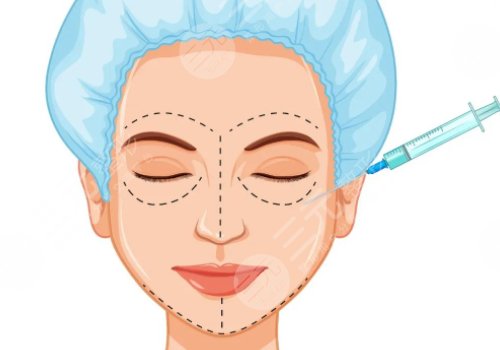 雙美膠原蛋白填充淚溝能維持多久？